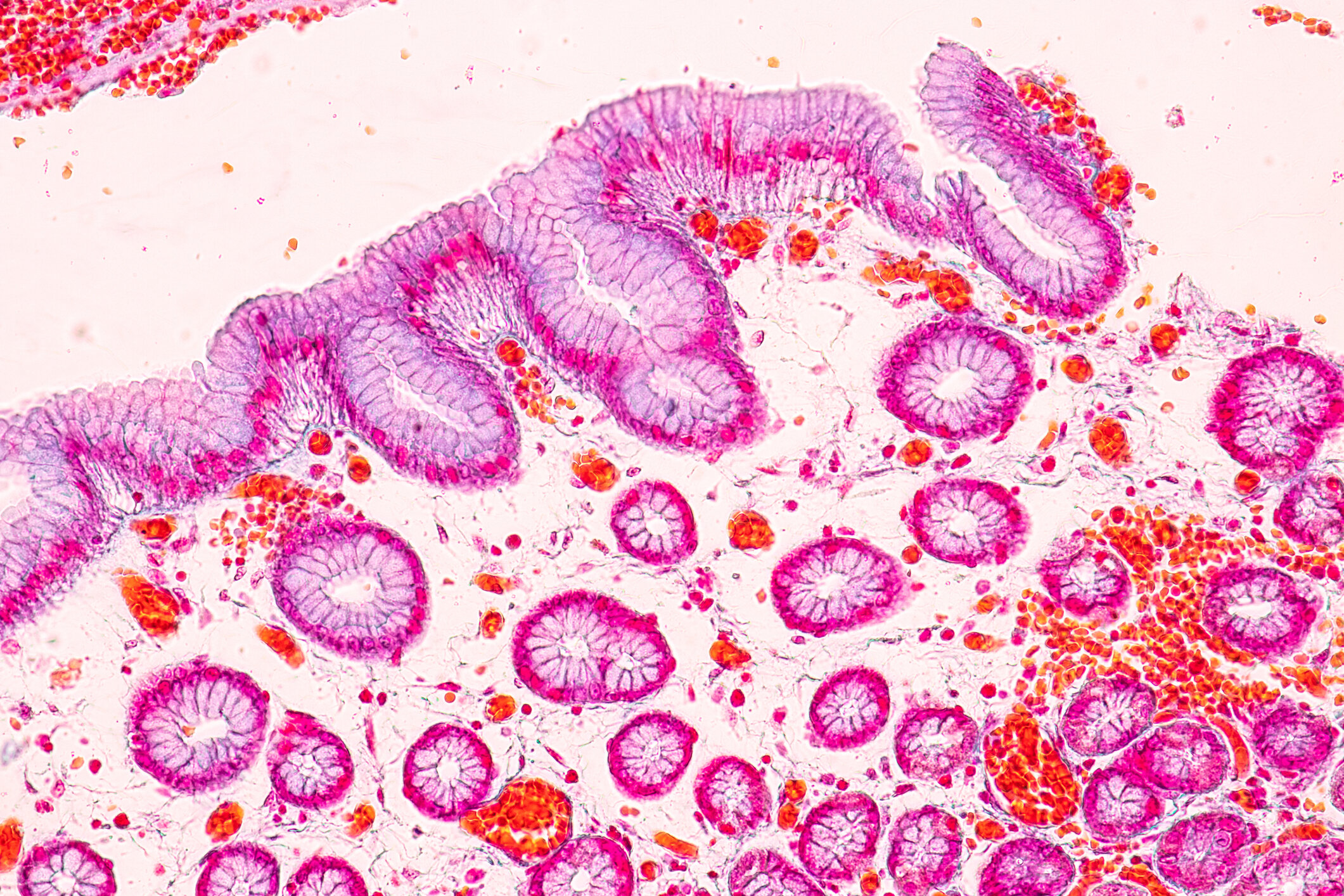 Our Model — Digestive Disease Research Foundation