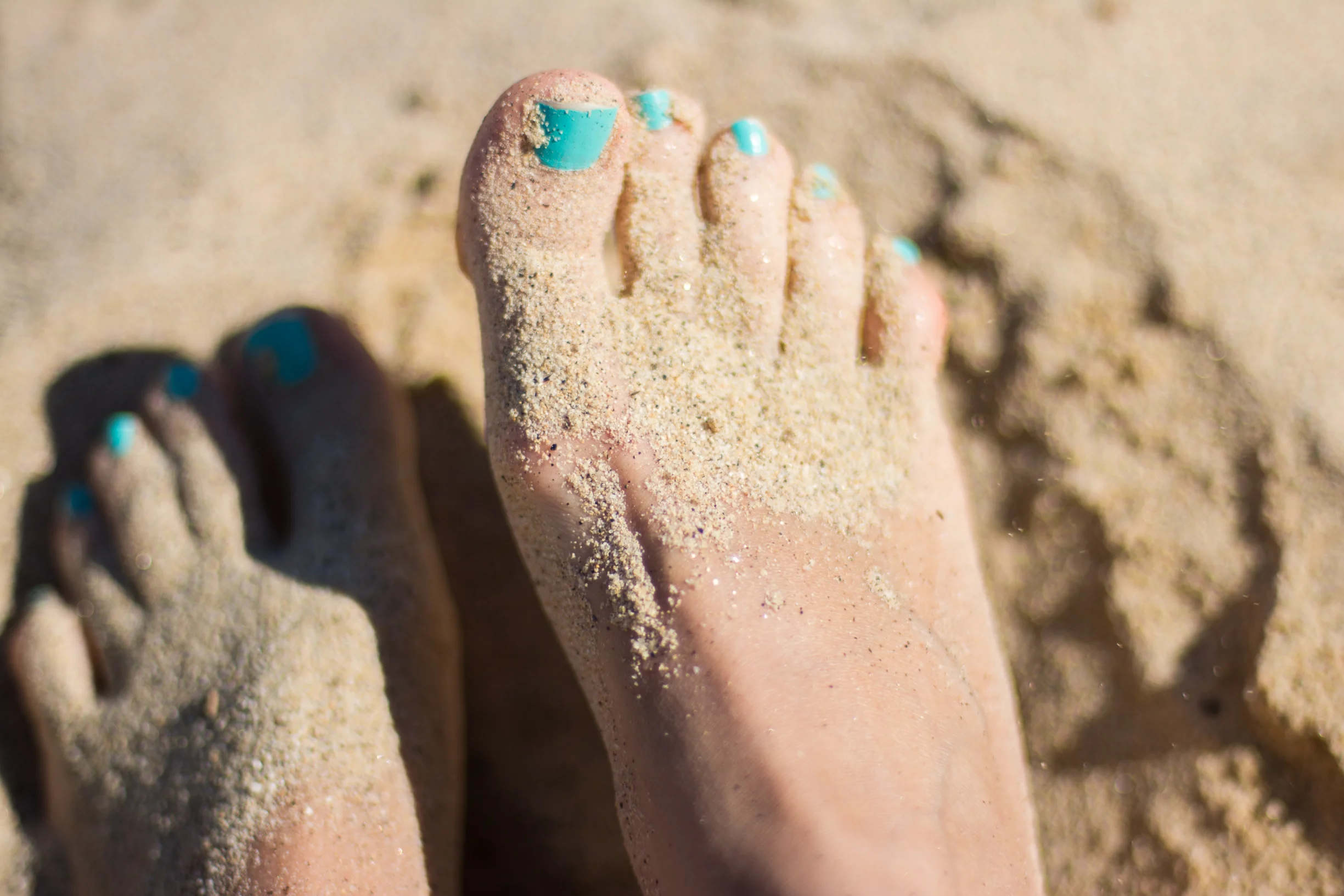 Bunions - Your questions answered
