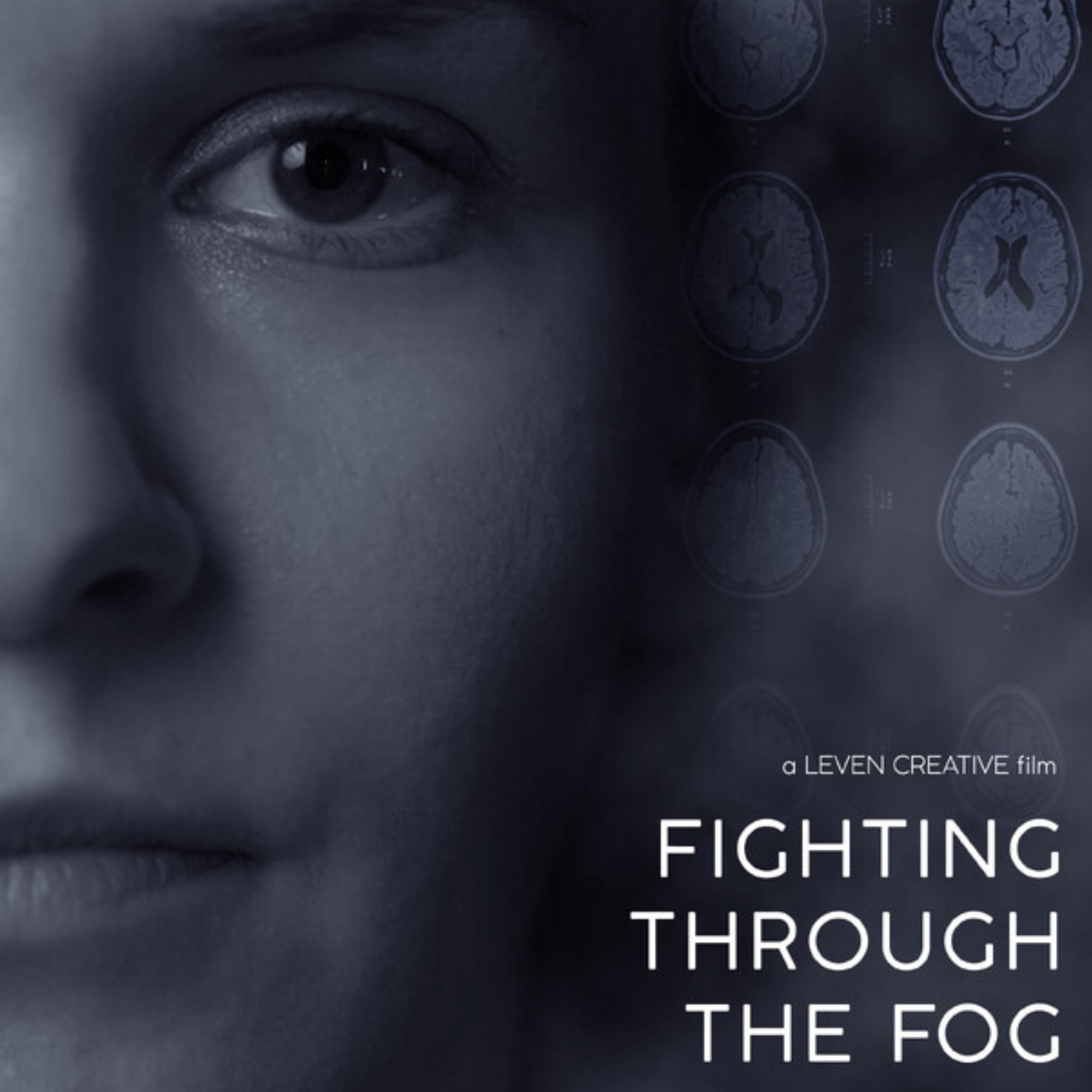 Perspective Alberta Screening Series: Fighting Through the Fog
