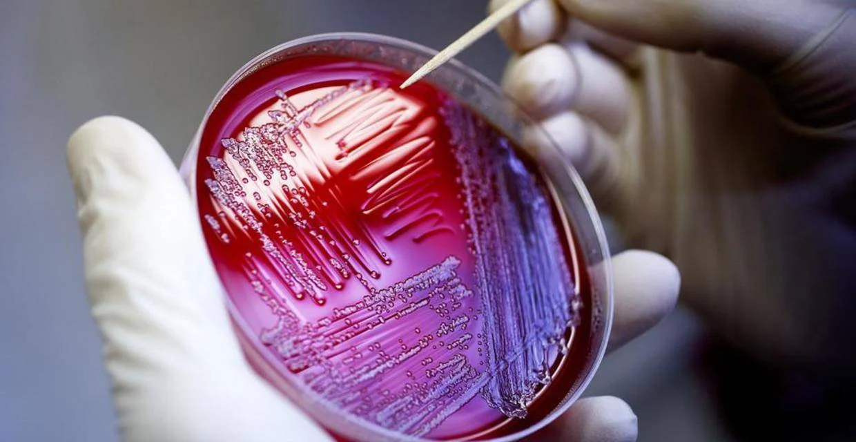 E-coli.jpg