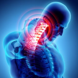 Specializzato Nel Trattare Sciatica Cervicale Ernia Disco Protrusioni Mal Di Testa Brachialgia