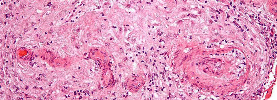 3dp_bioprintedplacenta_hypertension_preeclampsia_crop_940.jpg