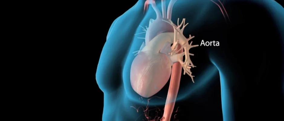 3D Printed Heart Surgery