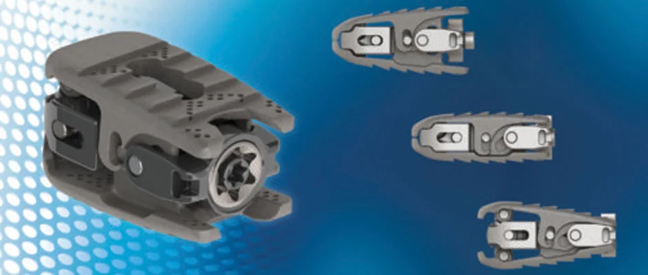 3D Printing Spinal Implant