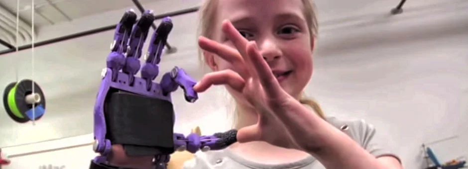3D Printing Prosthetics