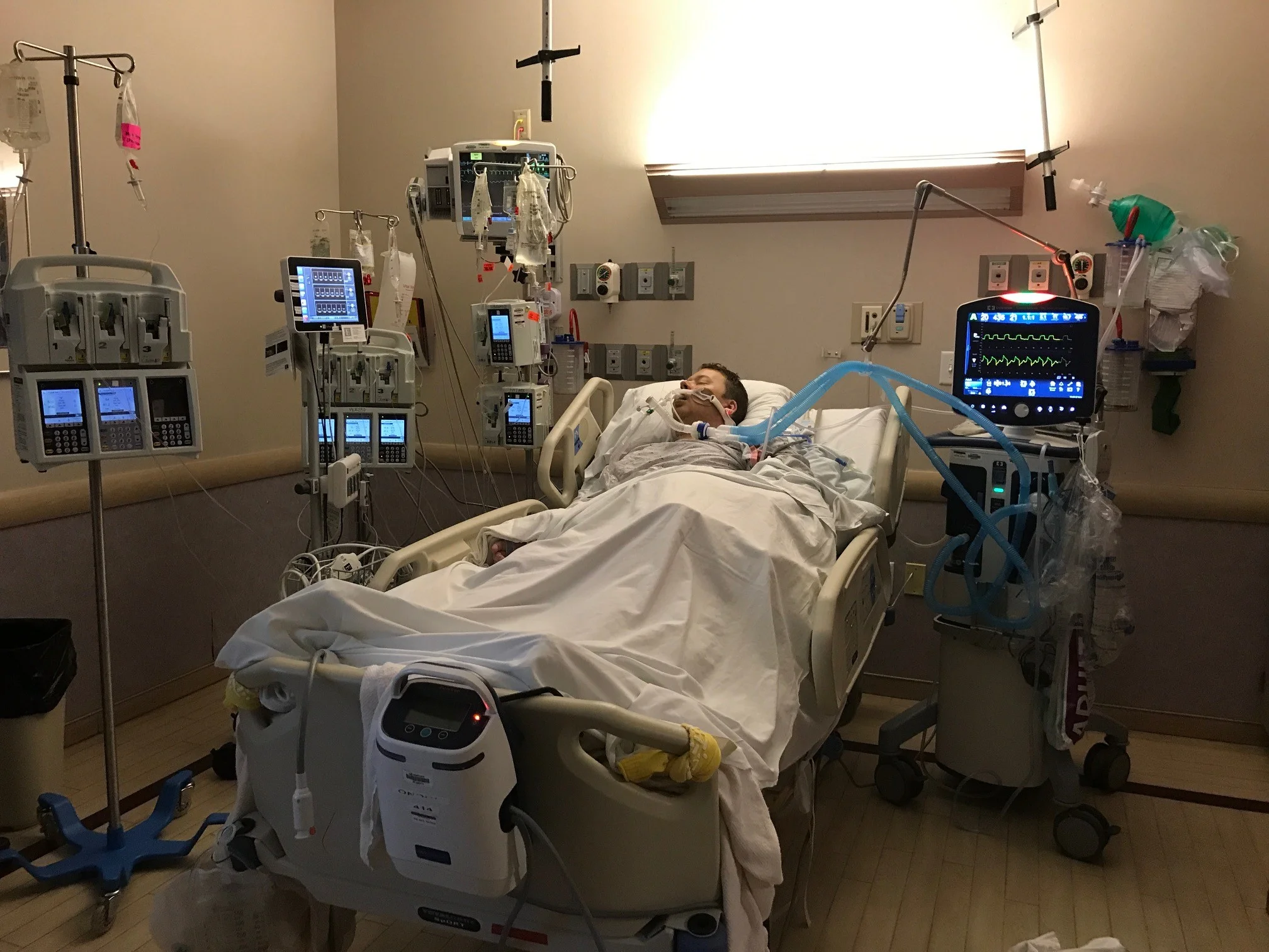 8/8/17 in the coma.