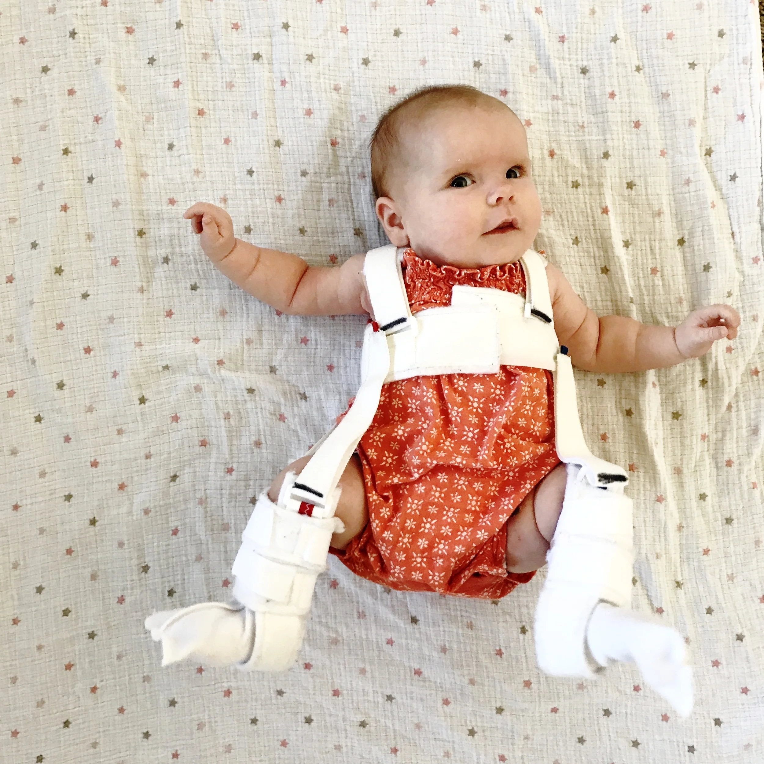 Two months old and in her pavlik harness to correct the hip dysplasia.