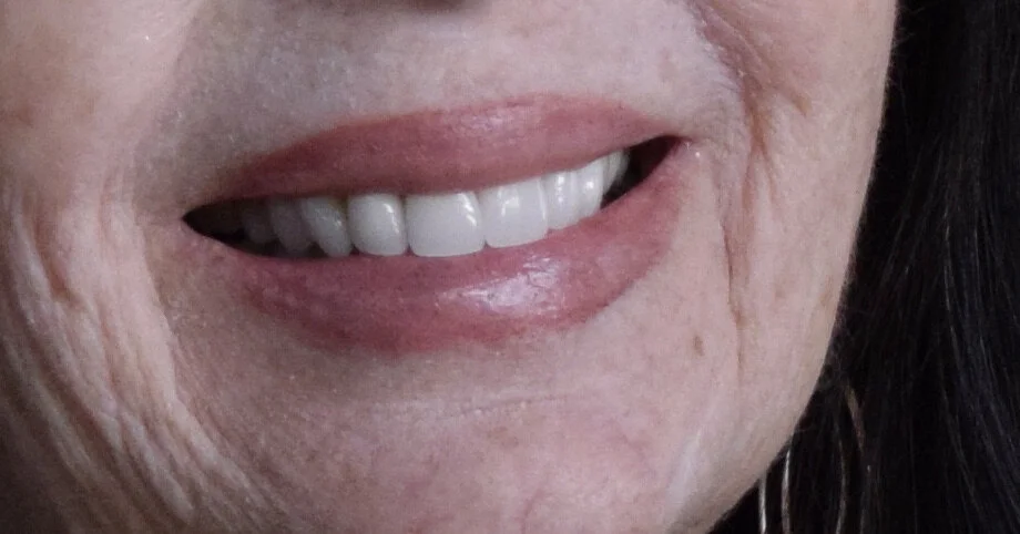 50 WAYS TO LEAVE YOUR DENTIST