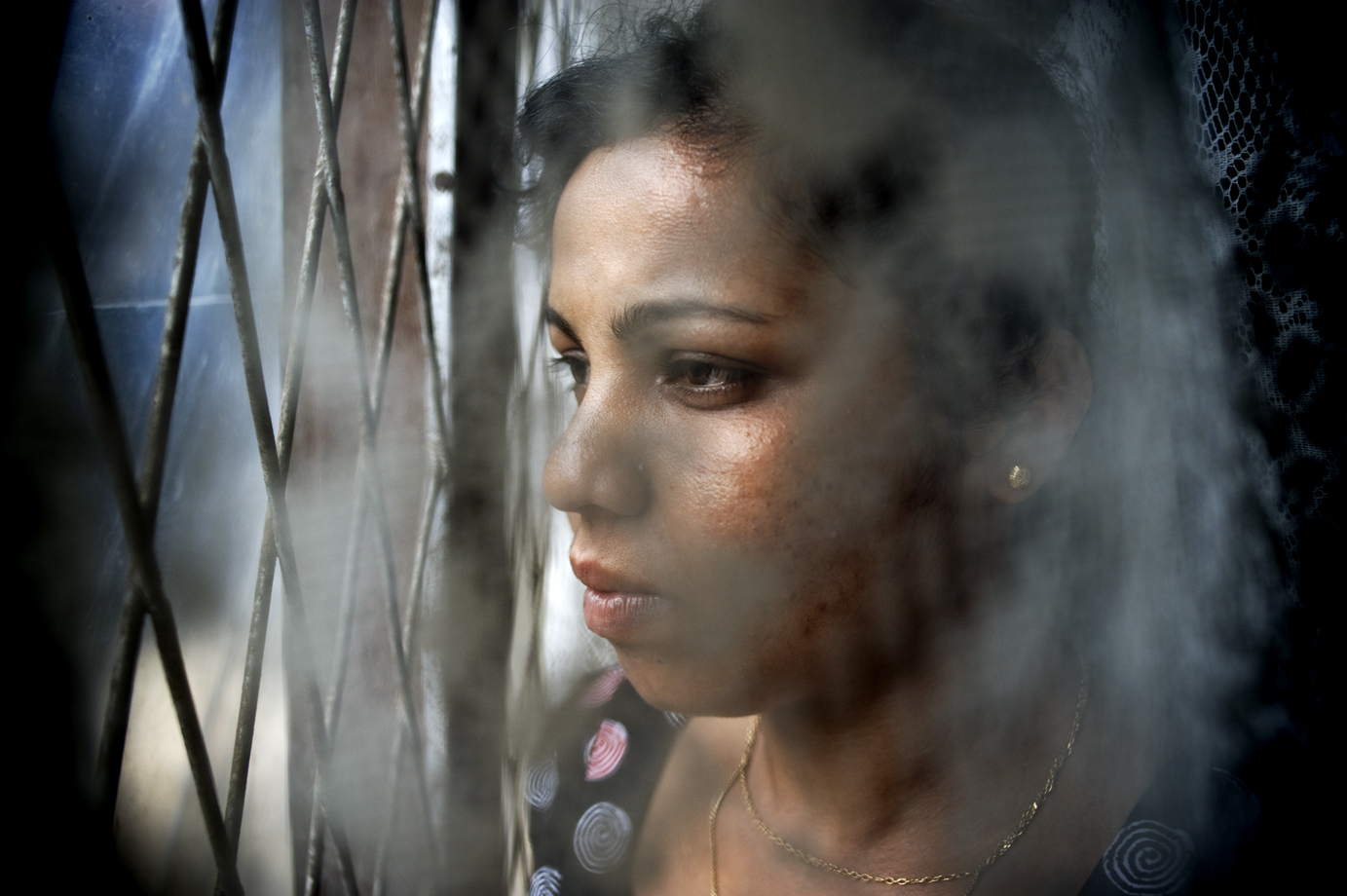  A former maid who escaped from Saudi Arabia after violent abuse from the employer / Sri Lanka  