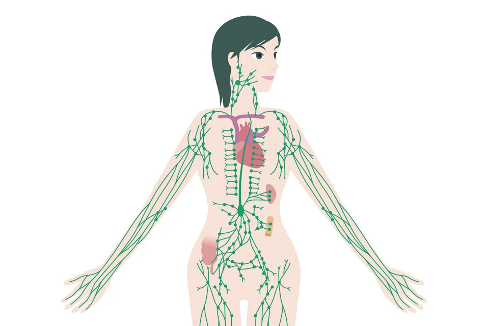 Lymphedema is commonly a complication of cancer treatment.