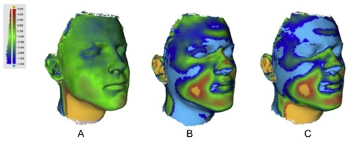 Topographical results from a 3D facial scan. ( Source )