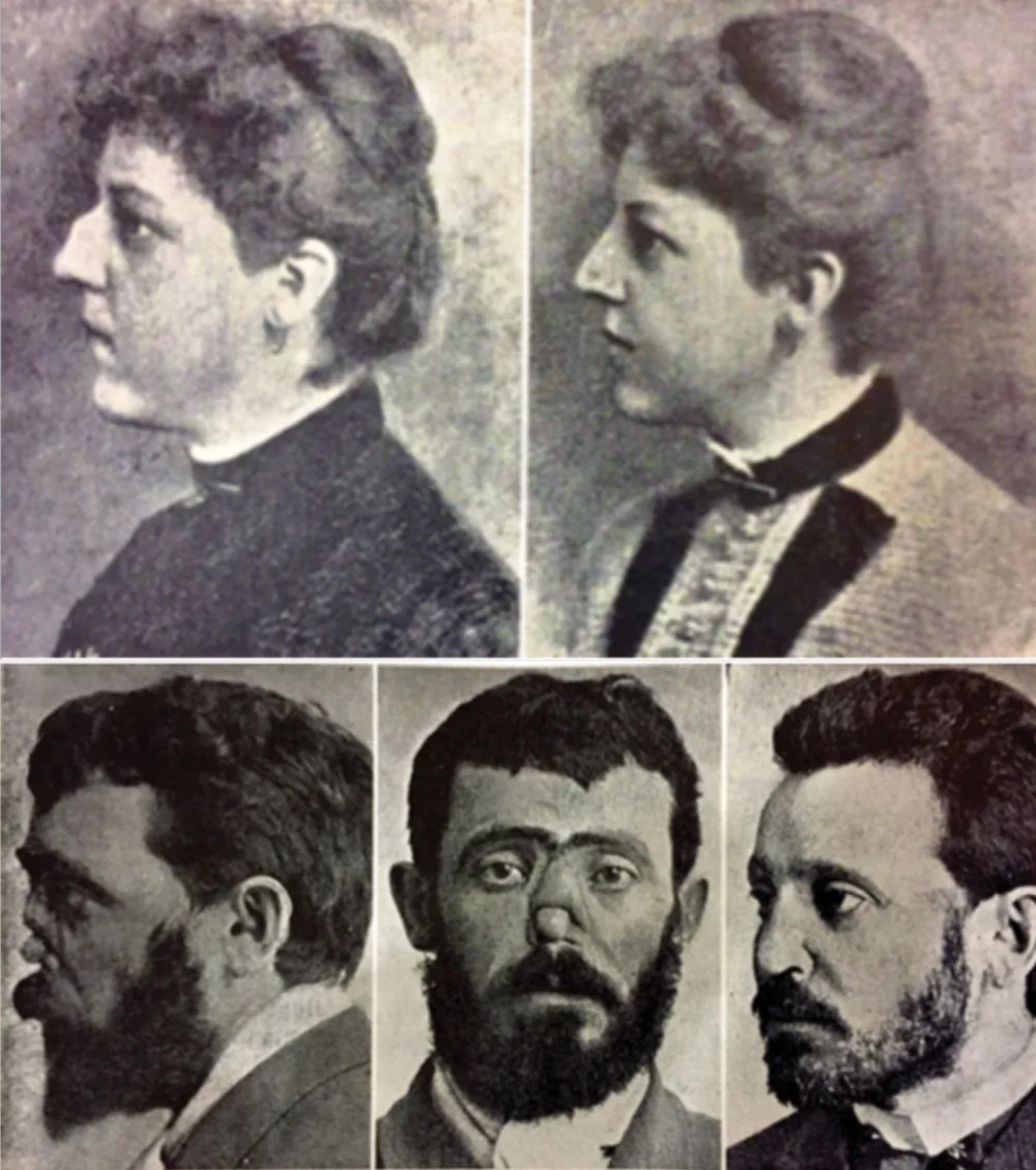 A collection of the earliest-known photographs used in plastic surgery planning and documentation ( Source ).