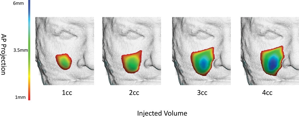 3D imaging enables scientists to identify and plan how to repair soft-tissue volumetric deficits, among other issues ( Source ).