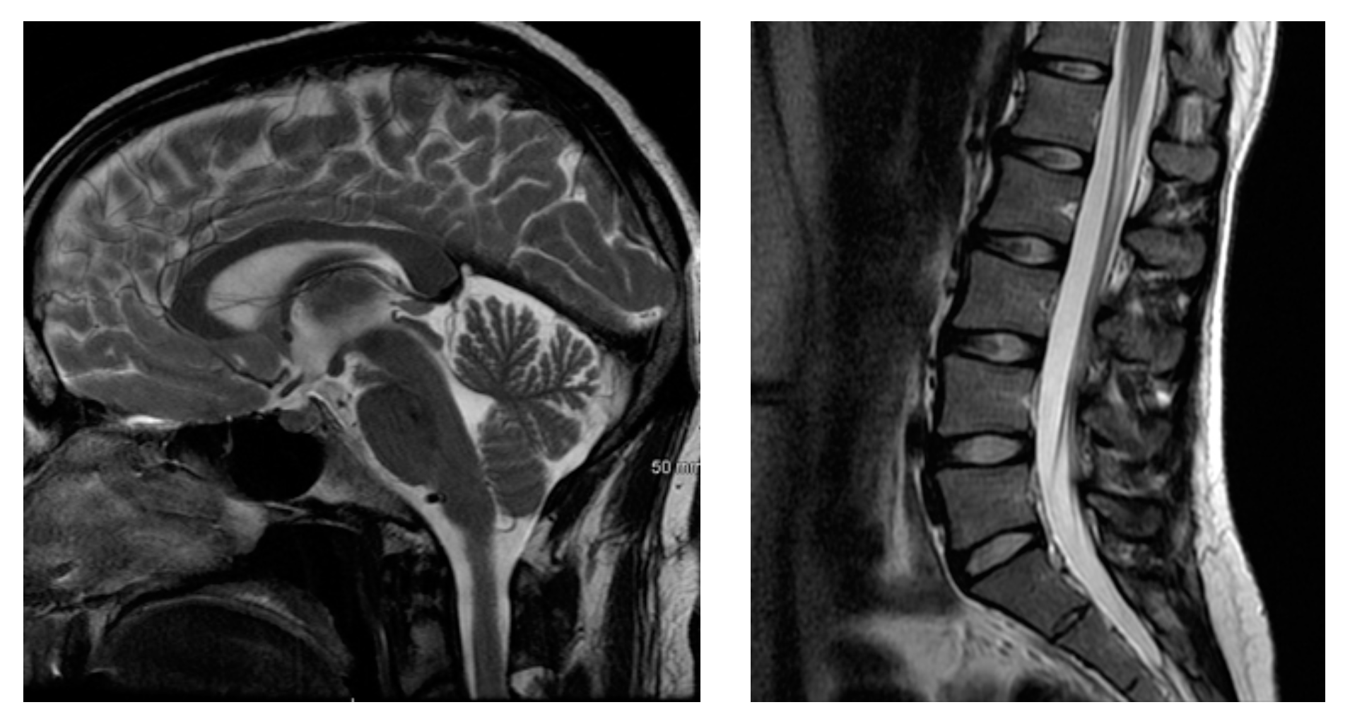 Medical Imaging Ct Scans Mri And More Mirrorme3d