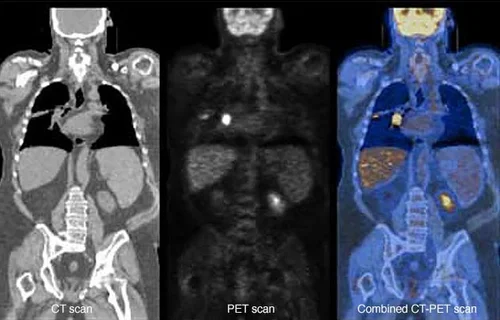 Medical Imaging Ct Scans Mri And More Mirrorme3d