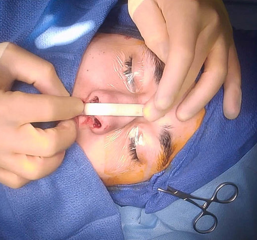 AG+intraop+edit.png