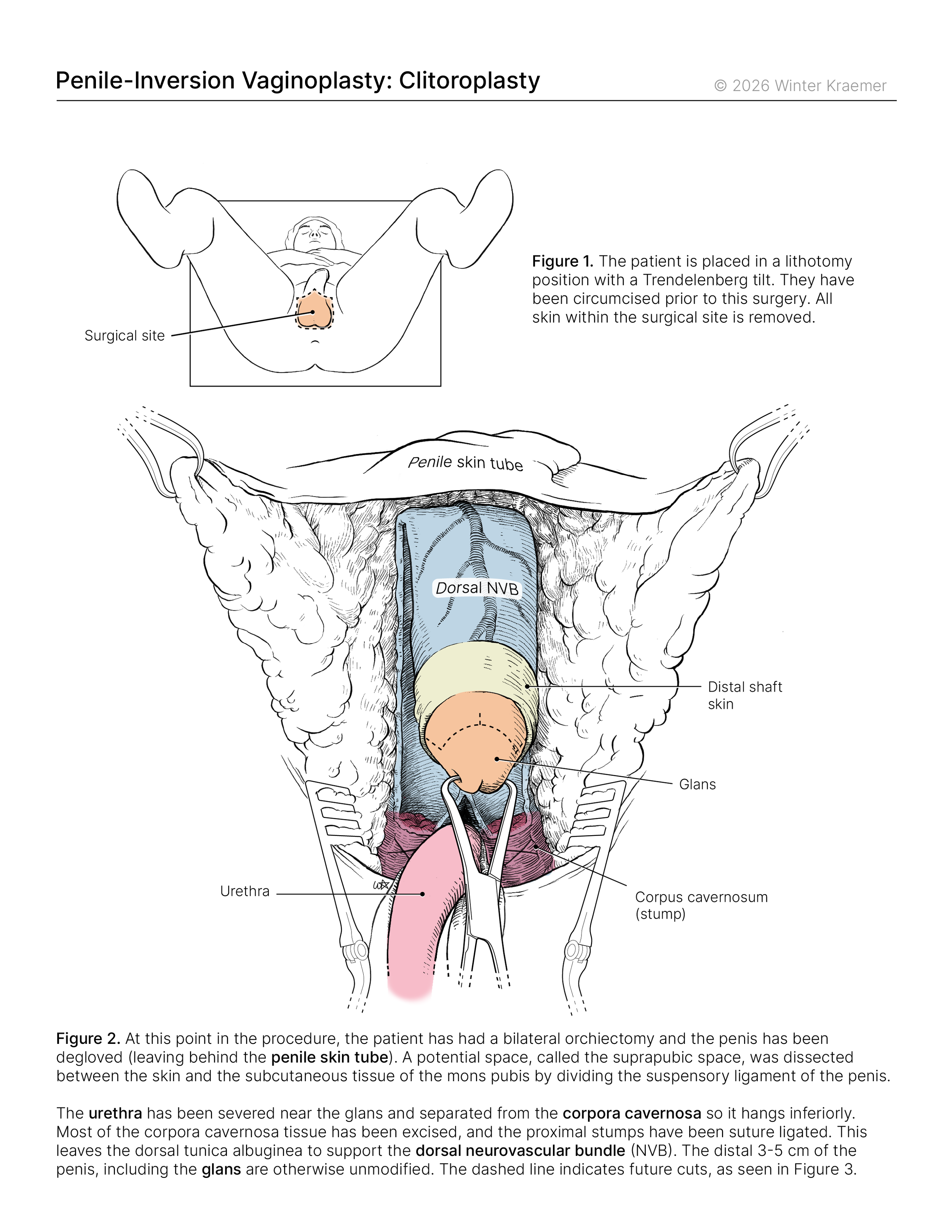surgical _colour_SG_1.png