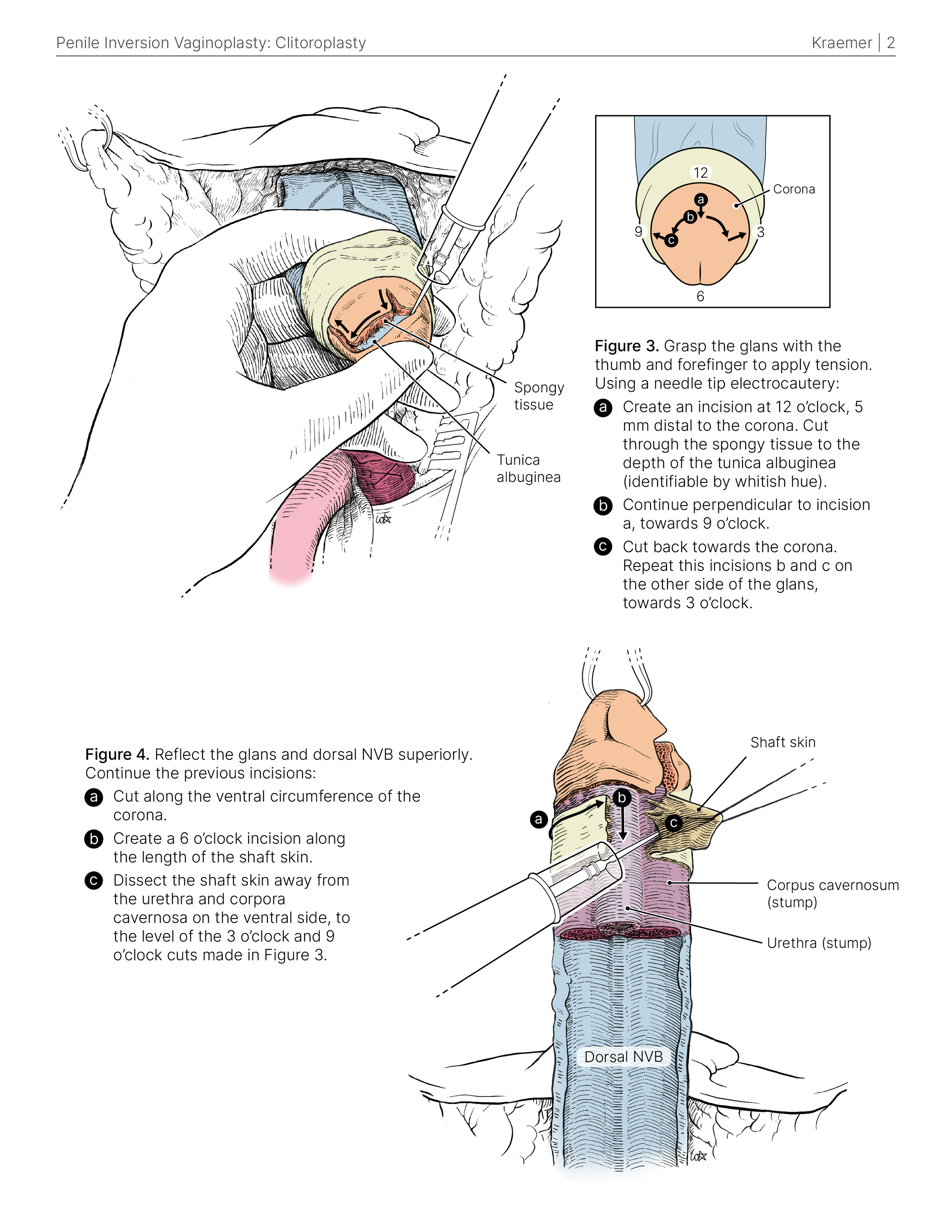 surgical _colour_SG_2.png