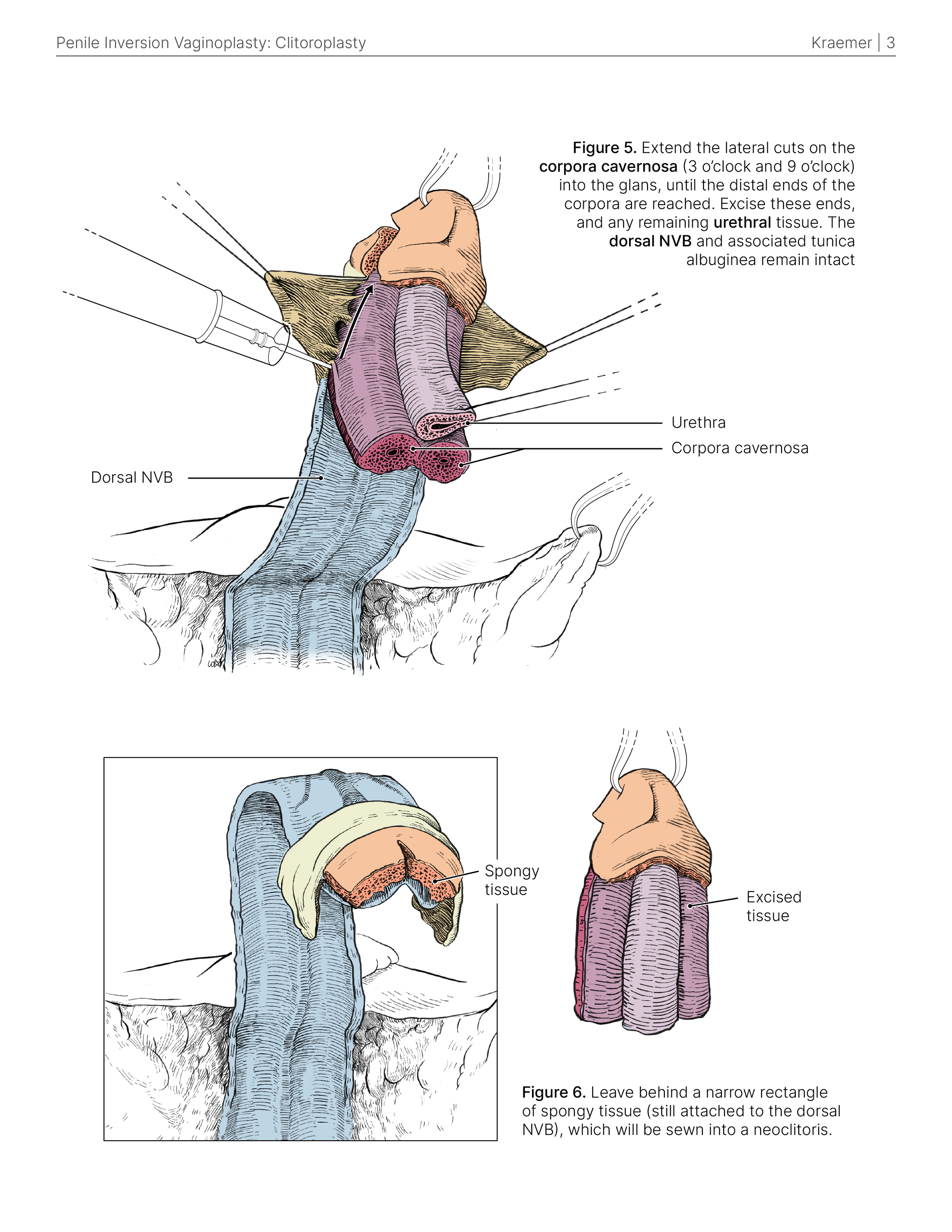 surgical _colour_SG_3.png