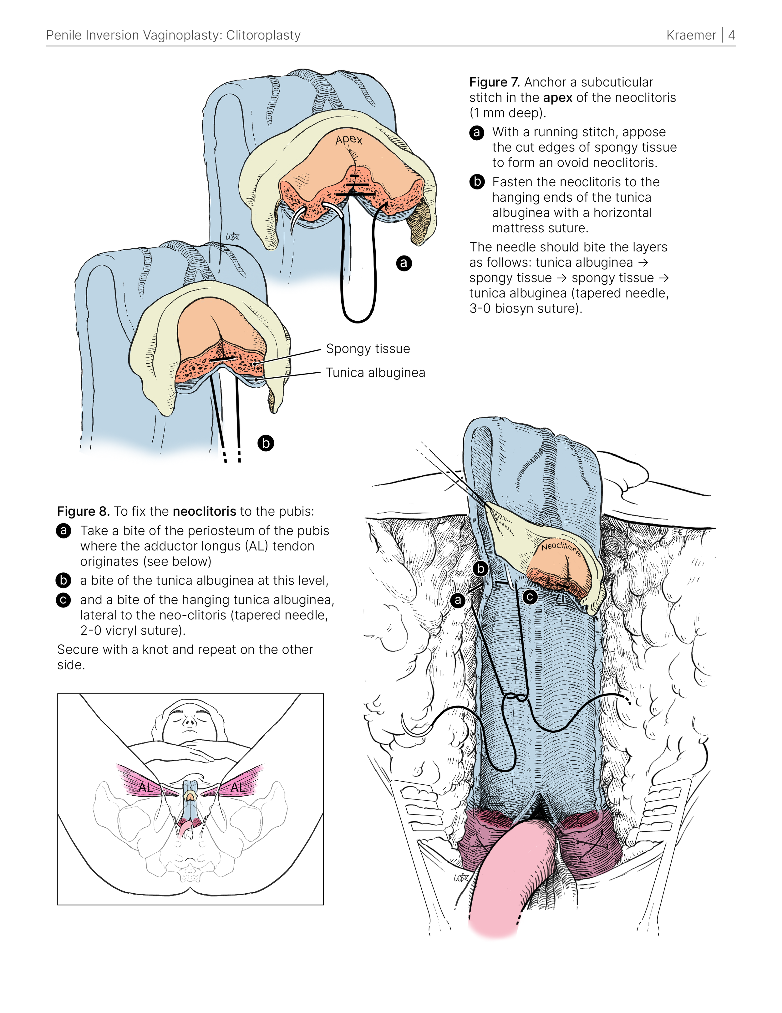 surgical _colour_SG_4.png