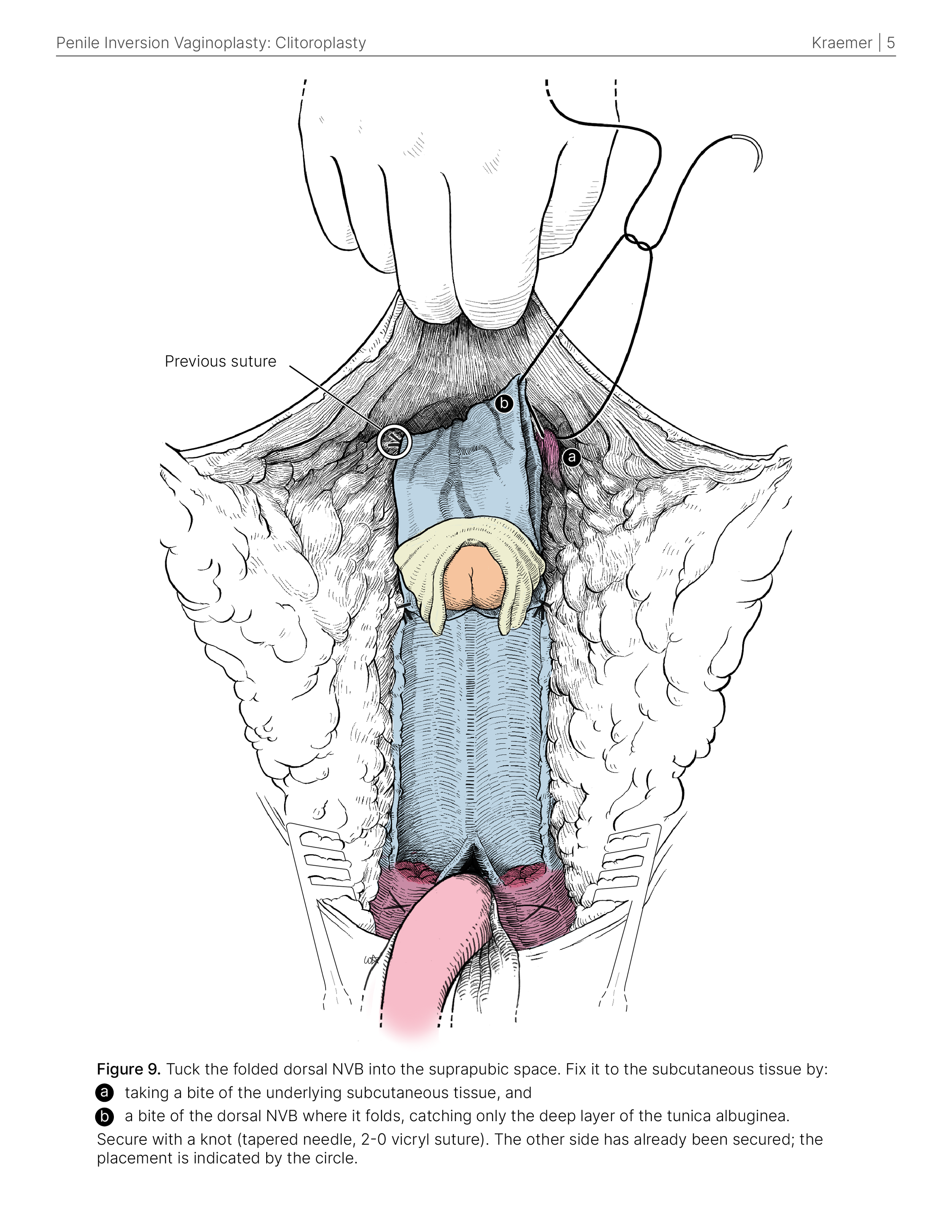 surgical _colour_SG_5.png