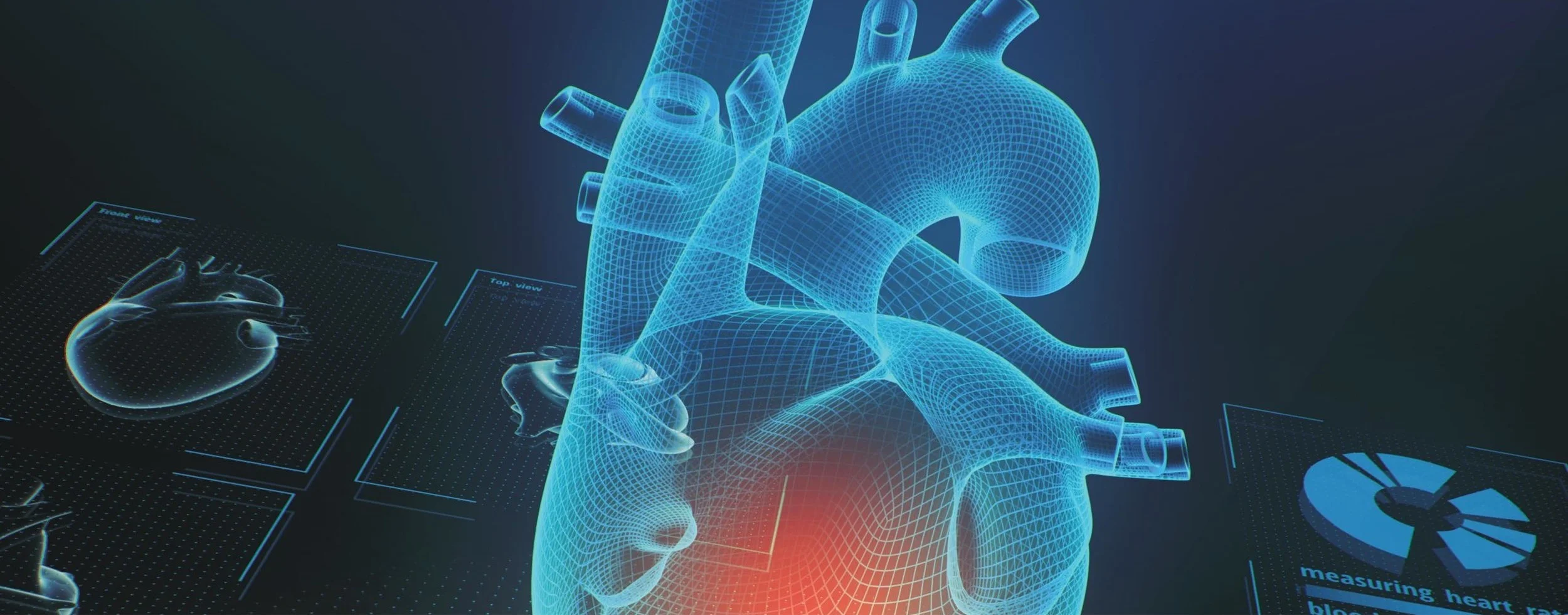 Transcatheter Mitral Valve Technologies: The Heart of Cardiovascular Device Innovation