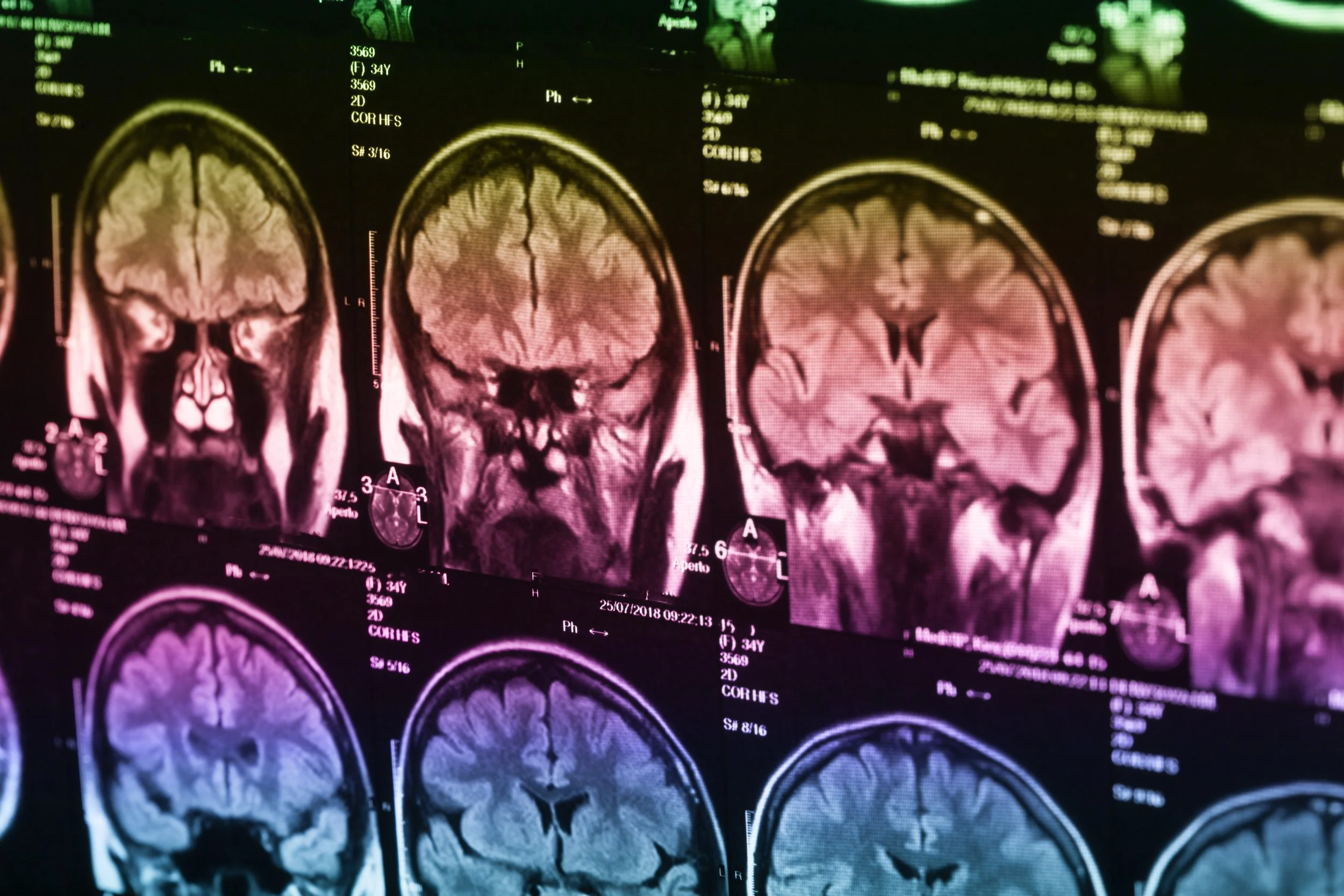 The Radiopharmaceutical Renaissance:  Radiating Hope in Medicine