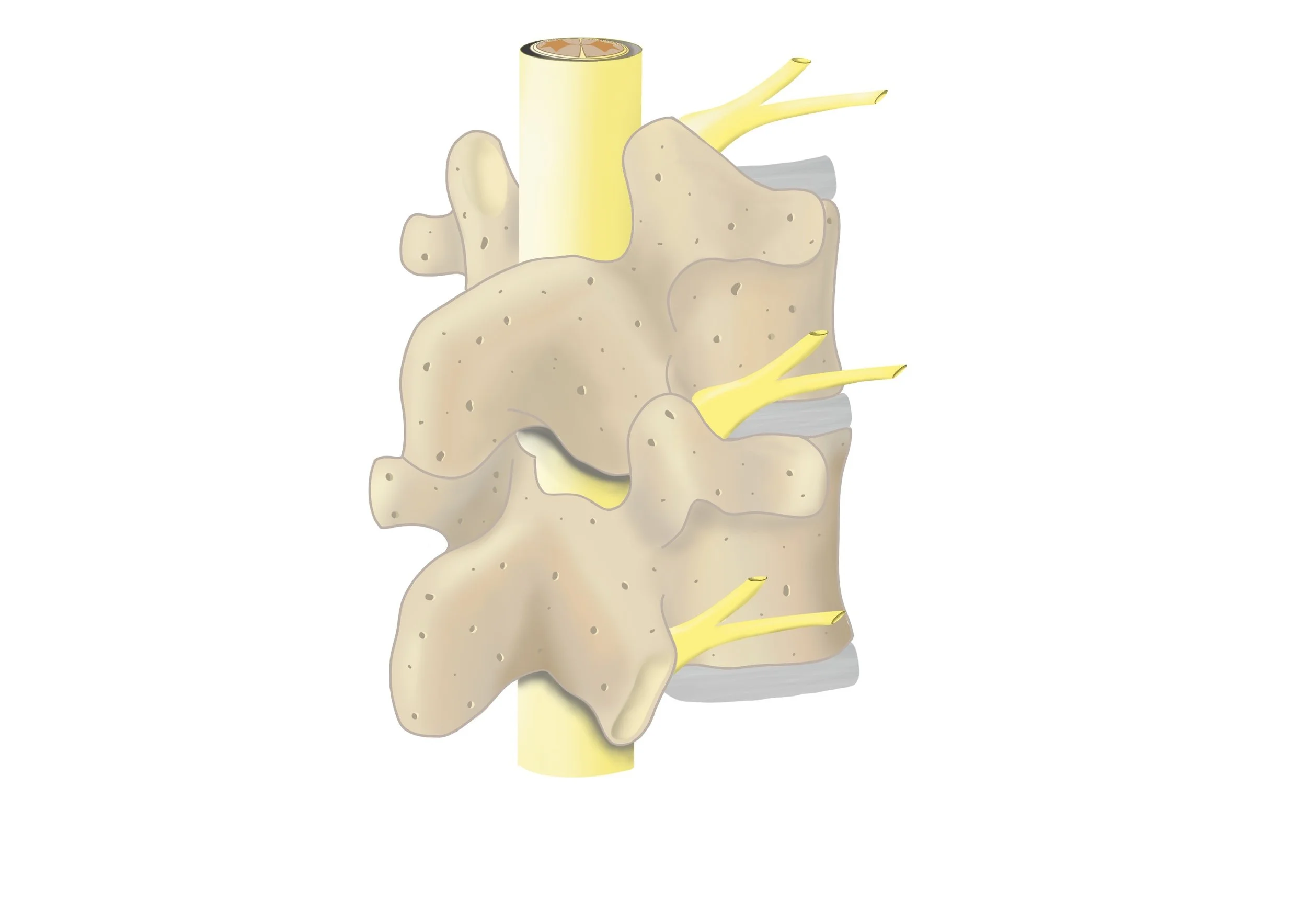 AMIT and Low Back Pain