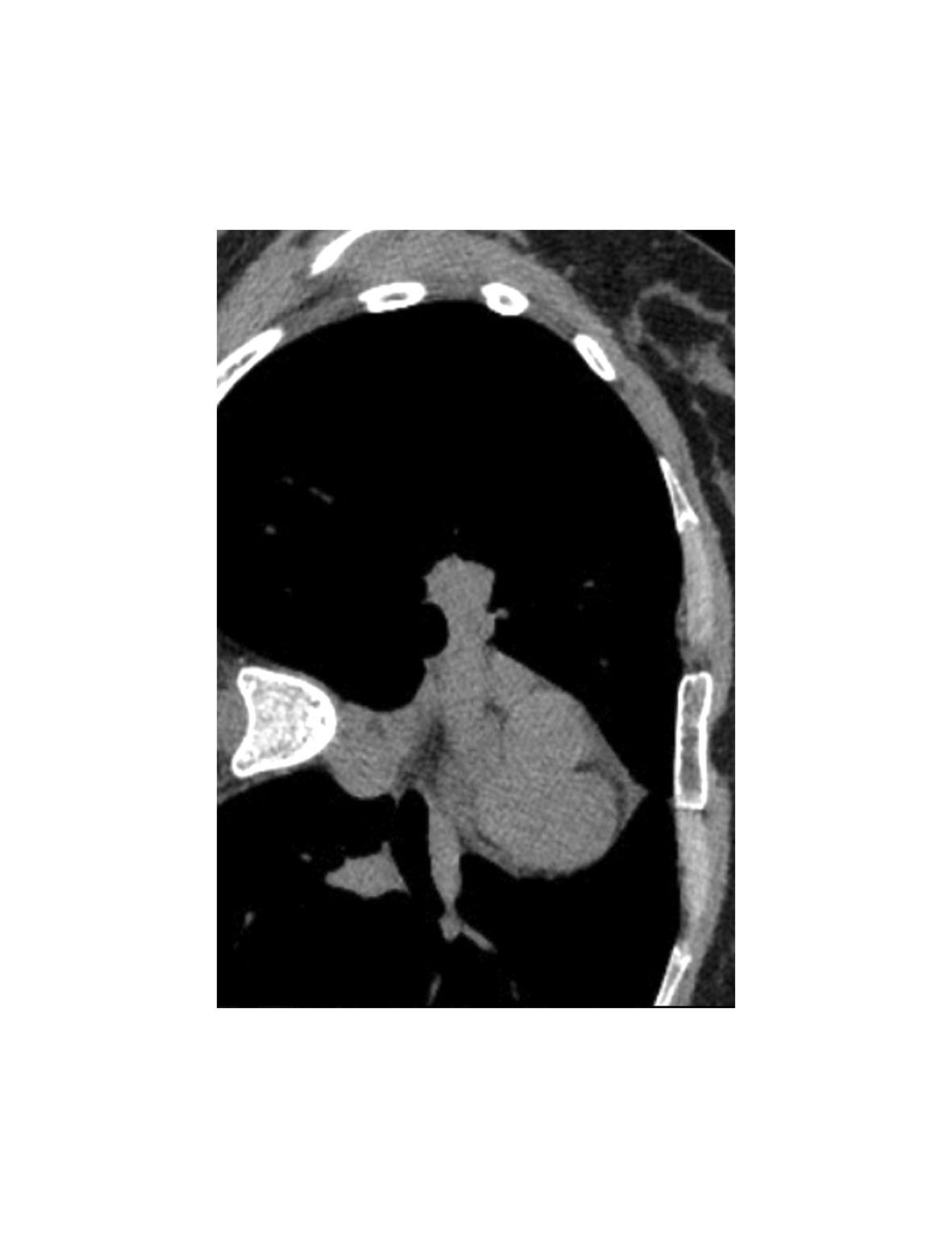 00-cd29-web-3.jpg