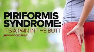 Piriformis Syndrome.jpg