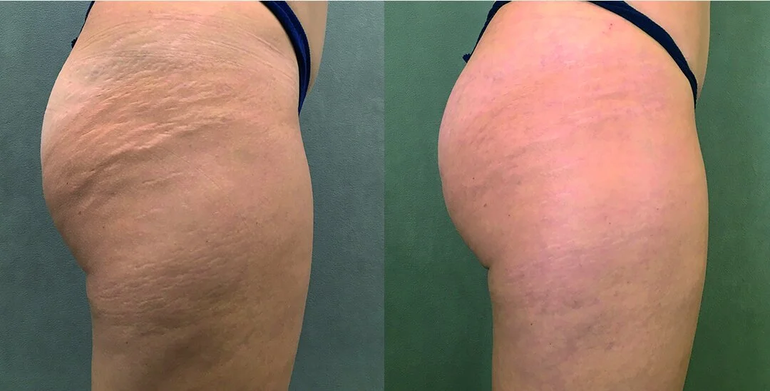 Left before - Right after