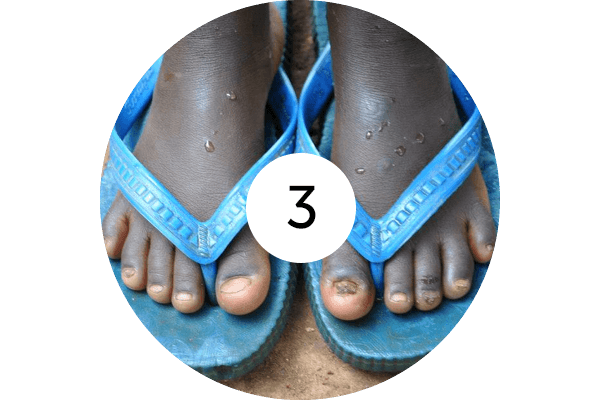 Treat_Step3@2x.png