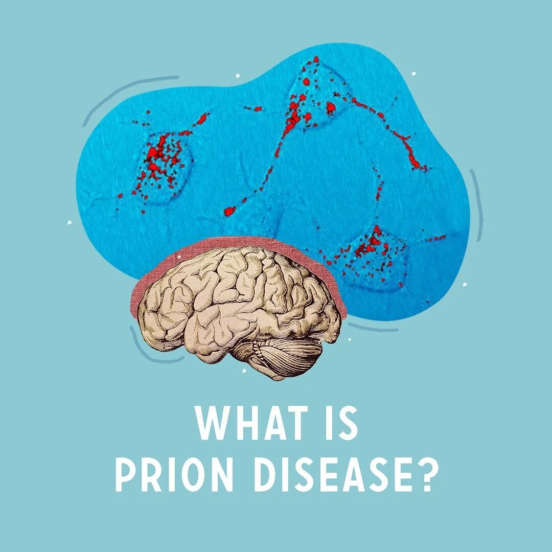 You probably have never heard of prion diseases before. We usually think about viruses and bacteria causing us harm. In prion diseases, a family of rare neurological disorders, the damaging agent is a misfolded protein which contains no genetic infor