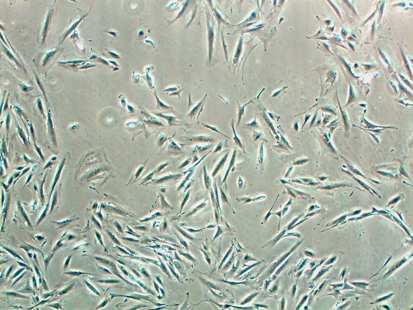 Olfactory neurosphere cells taken from the body, analysed for subtle differentiation of colour. Image courtesy of CNBP.