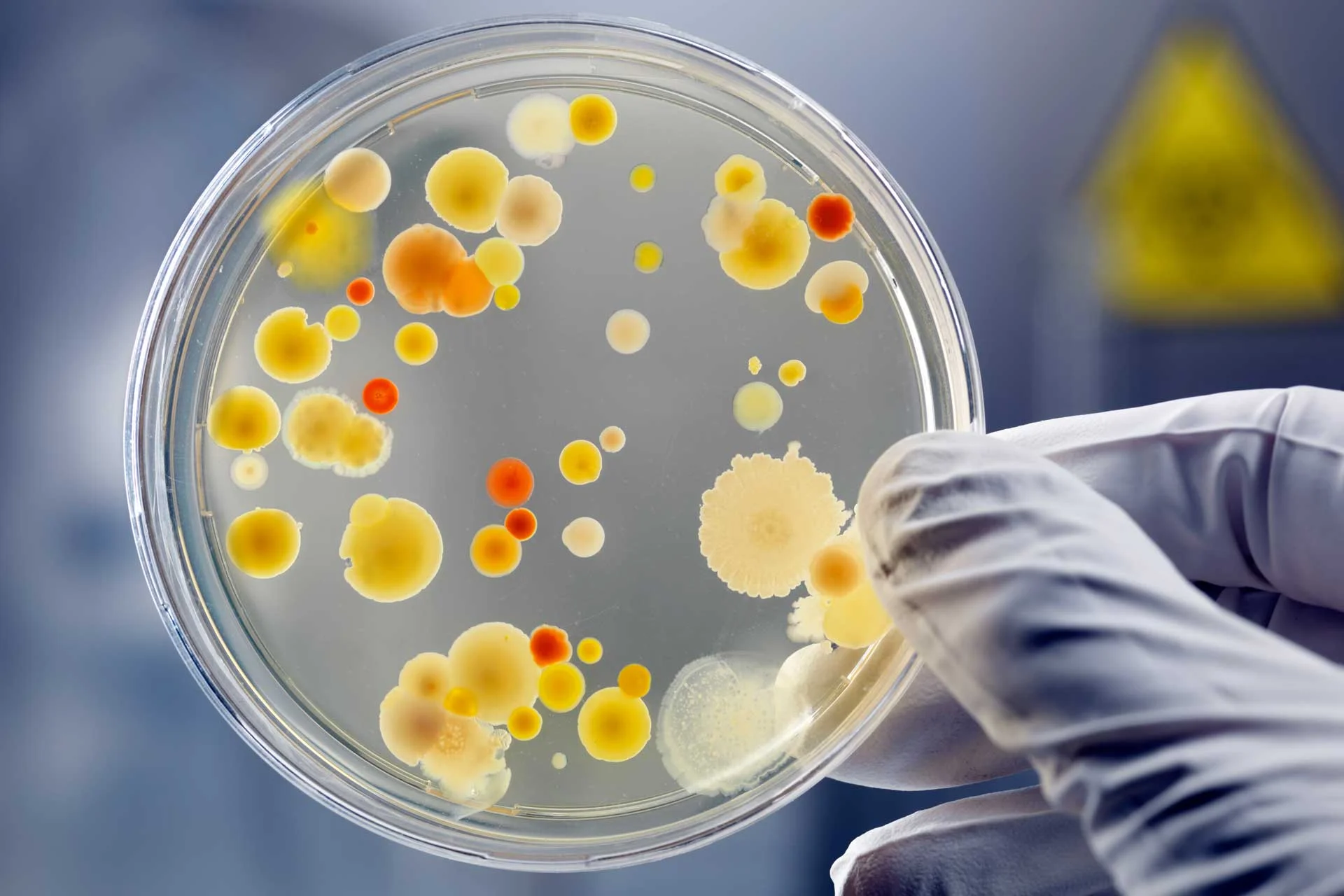 What Are Probiotics?