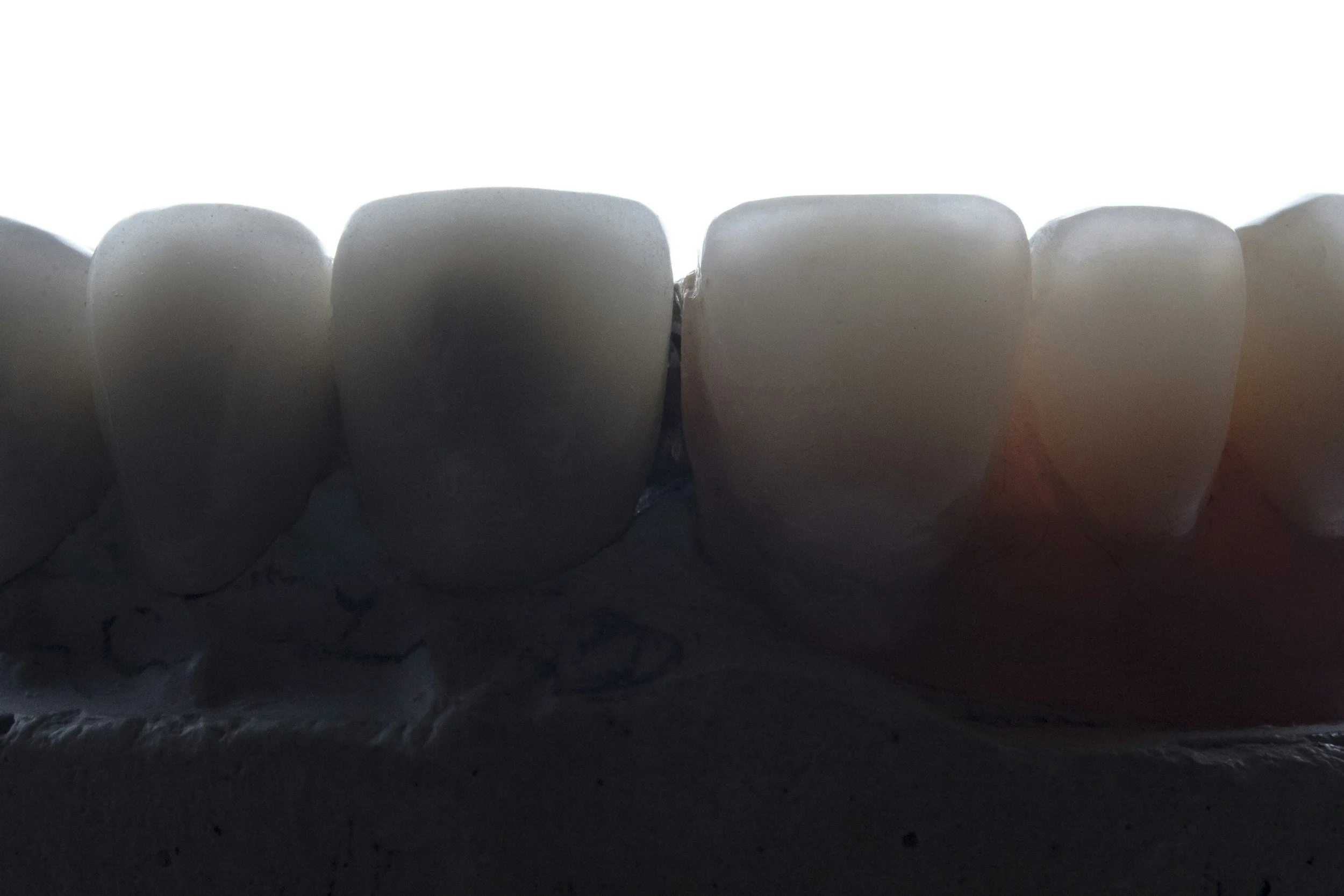 Close-up of white teeth, possibly on a dental model or sculpture, with bright backlight highlighting their surface.