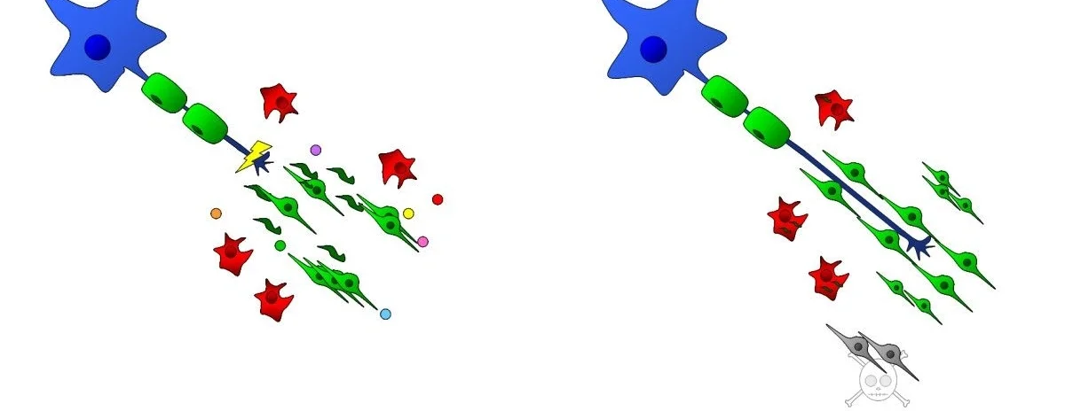 Successful axon regeneration requires growth-promoting responses by the injured neuron and by its local environment. Please see our J. Neuroinflammation review on axon degeneration and regeneration.