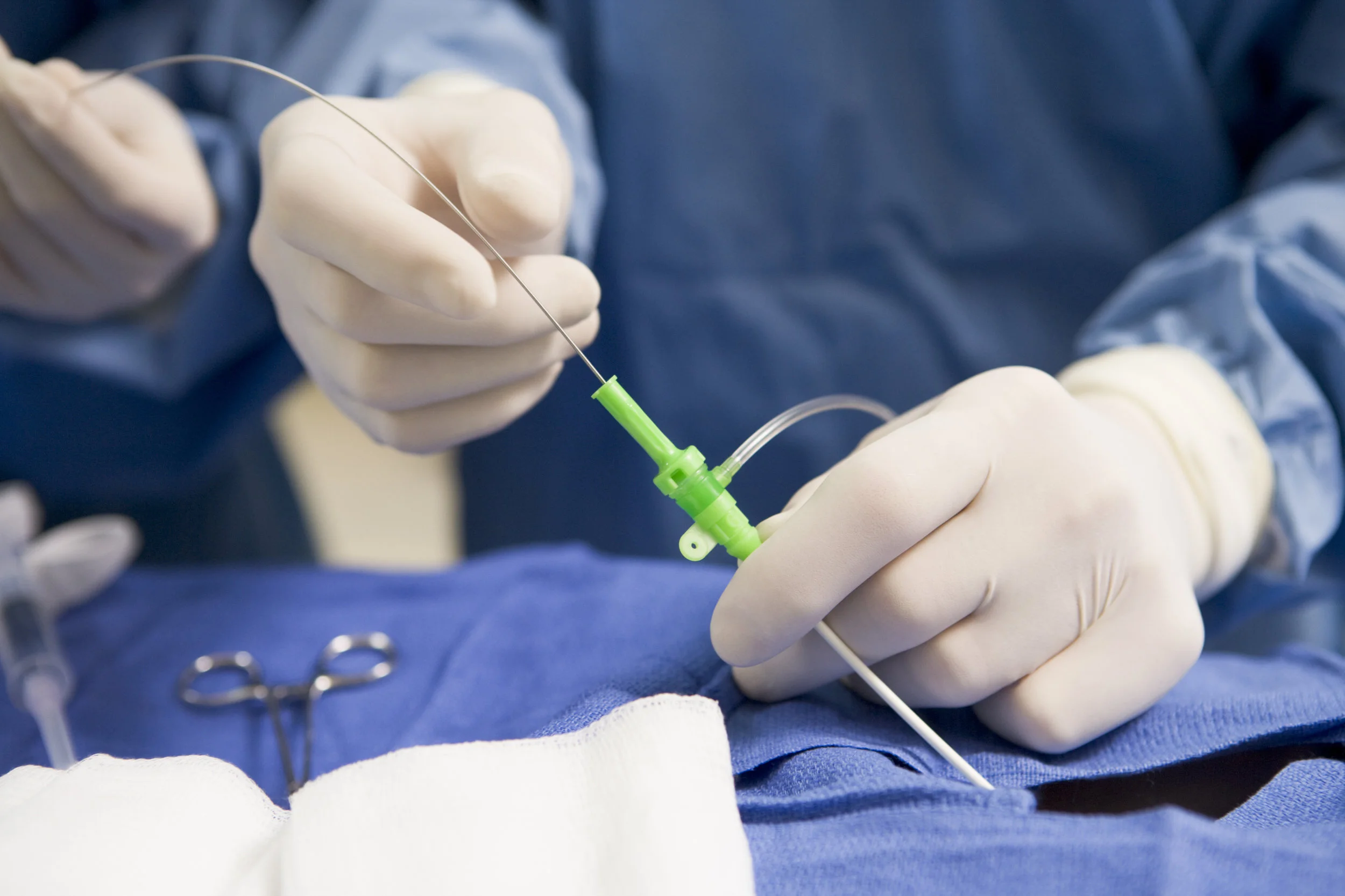 cardiac_surgery_image.jpg