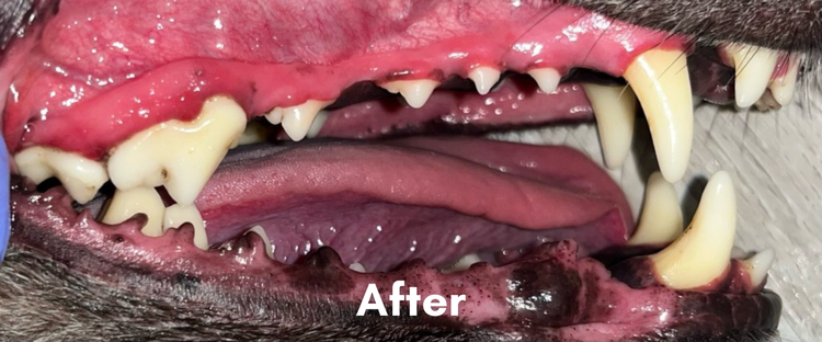 After dental.png
