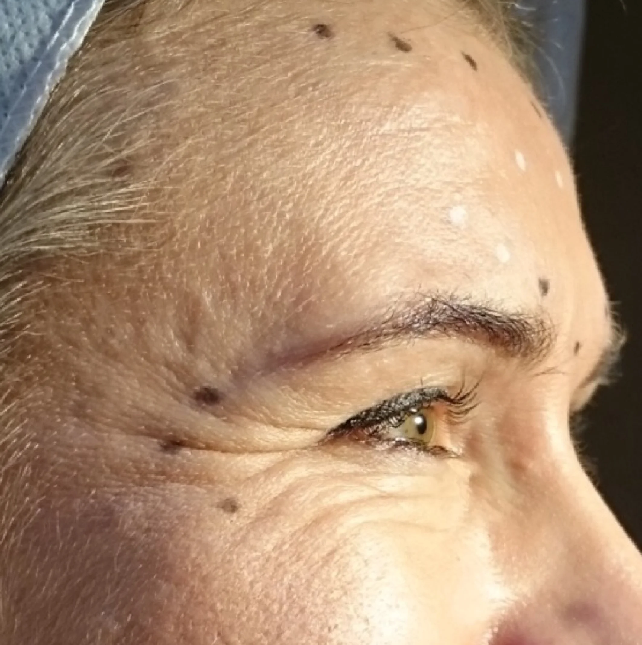 Wrinkles-03.jpg