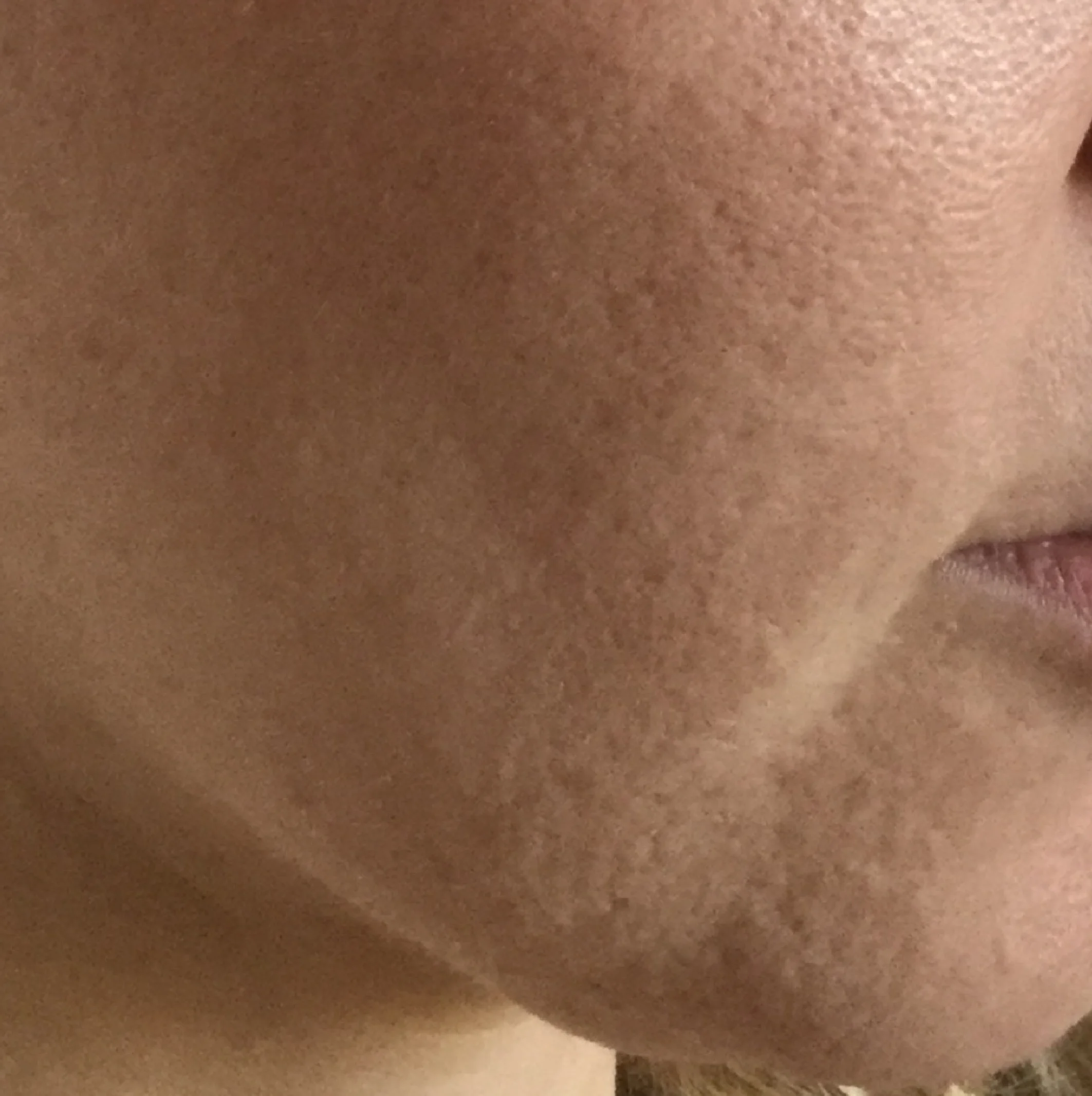 lazer resurface-01.jpg
