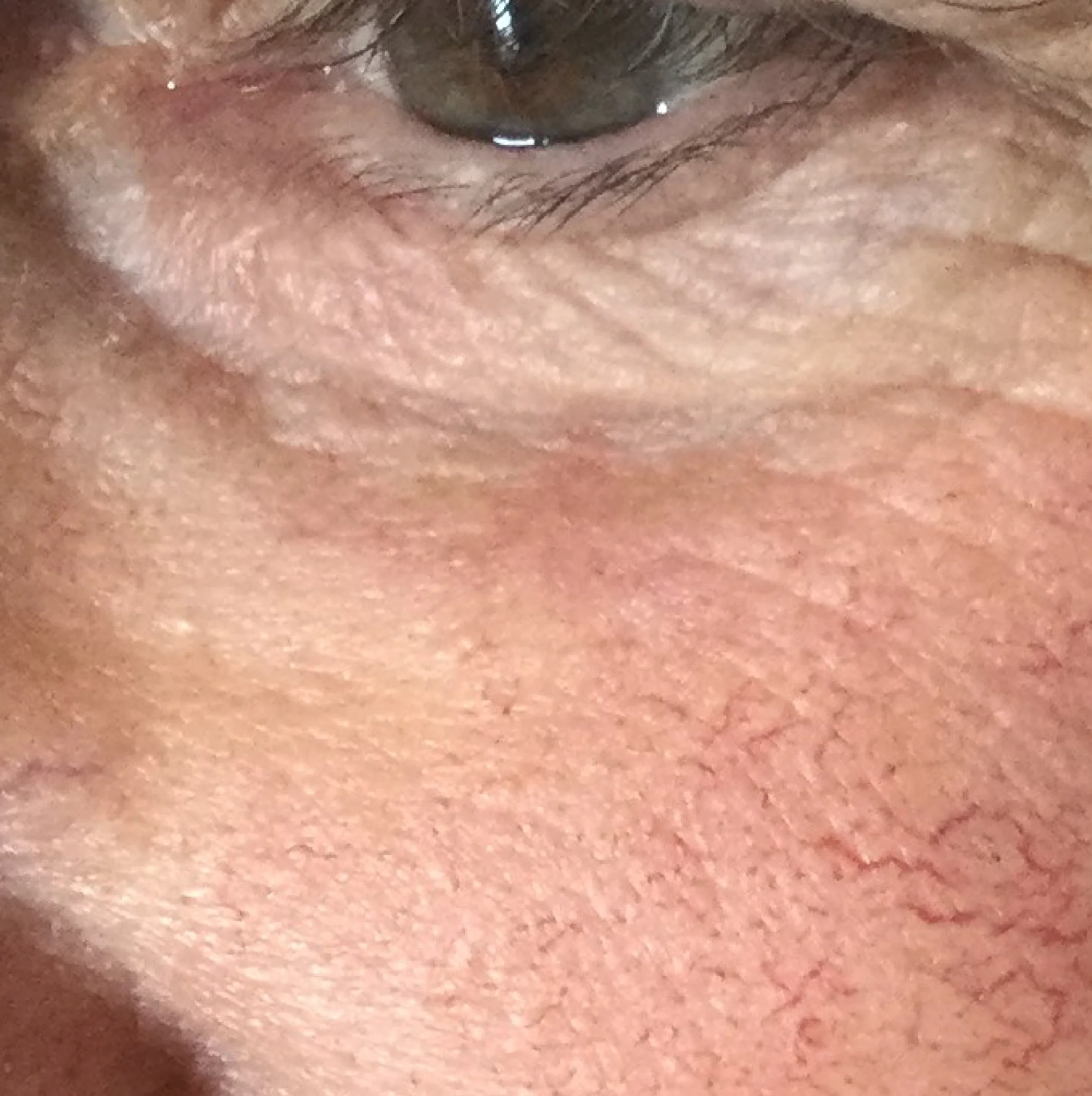 Lip_fillers-04.jpg