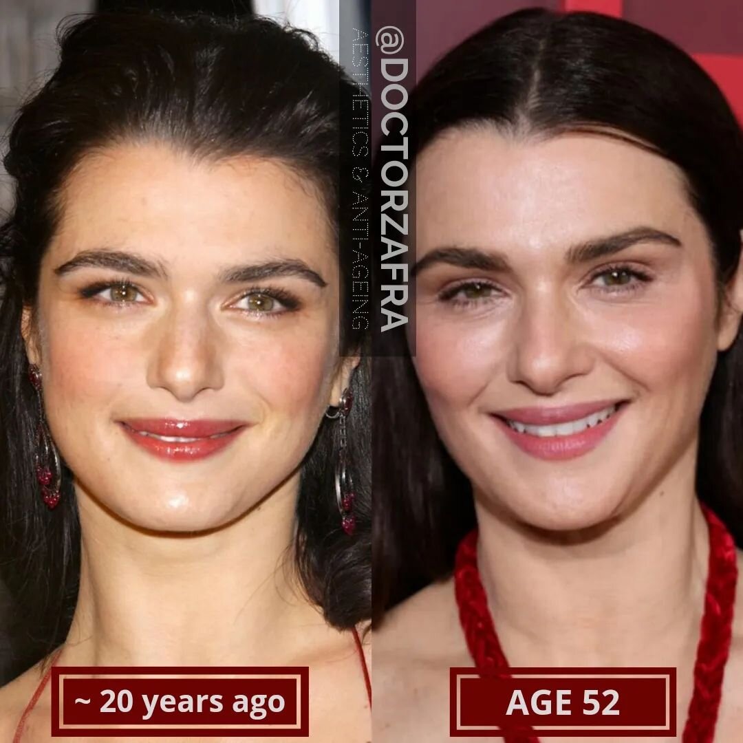 Rachel Weisz at 52 is our Monday motivation: &quot;Age gracefully&quot; and with a little help age beautifully! 😍
💫
Age gracefully and with a little help, age beautifully 🥰
💎
Discover all we can do to maintain, improve and restore your natural be