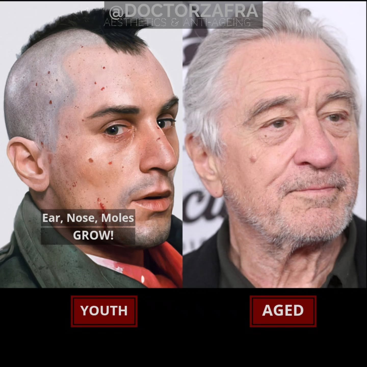 Ageing... it will happen to all of us and no matter what they say we cannot prevent it, its a fact of life. Preventing would be like saying you could stop time and gravity.
I hear the  it all the time, treatments that prevent this or that... its just