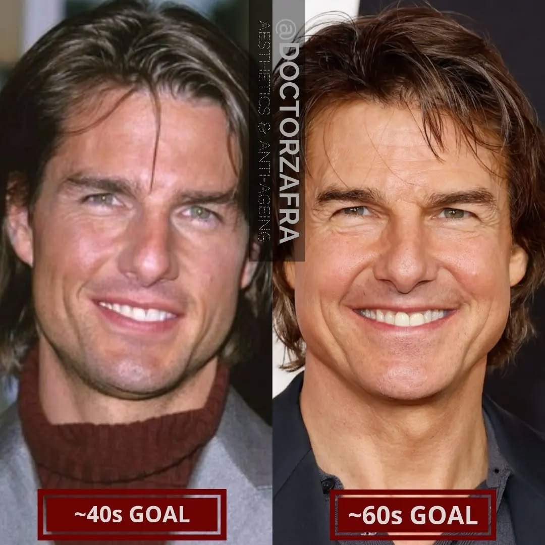 Gentlemen, Tom Cruise has been raising the bar for ageing, over the years he has had a few tweaks but has always looked the best for his age... so aesthetics and keeping fit and healthy is not a gender thing, come don't just let your self go, if ther