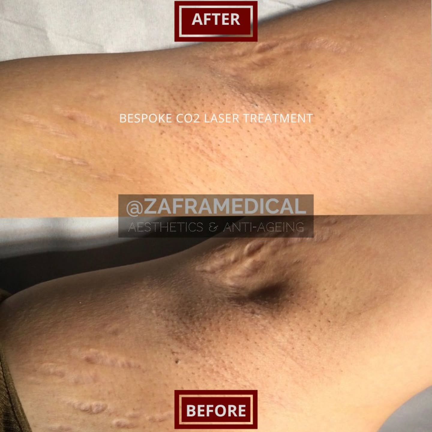 Our patients concerns and goals are our goals 🙏
⭐️
@doctorzafra creates treatment plans for each patient, as everyone is unique!
🙏
There is a reason why we dont take calls from anyone who is not our exisiting patient. The reason is because by text 