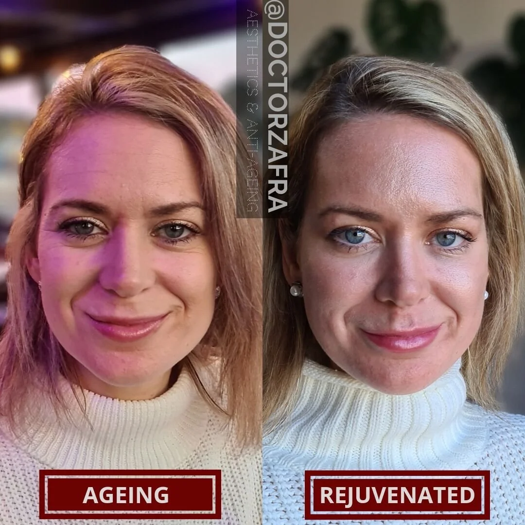 personalised-skin-rejuvenation-treatment-plan-results.jpg