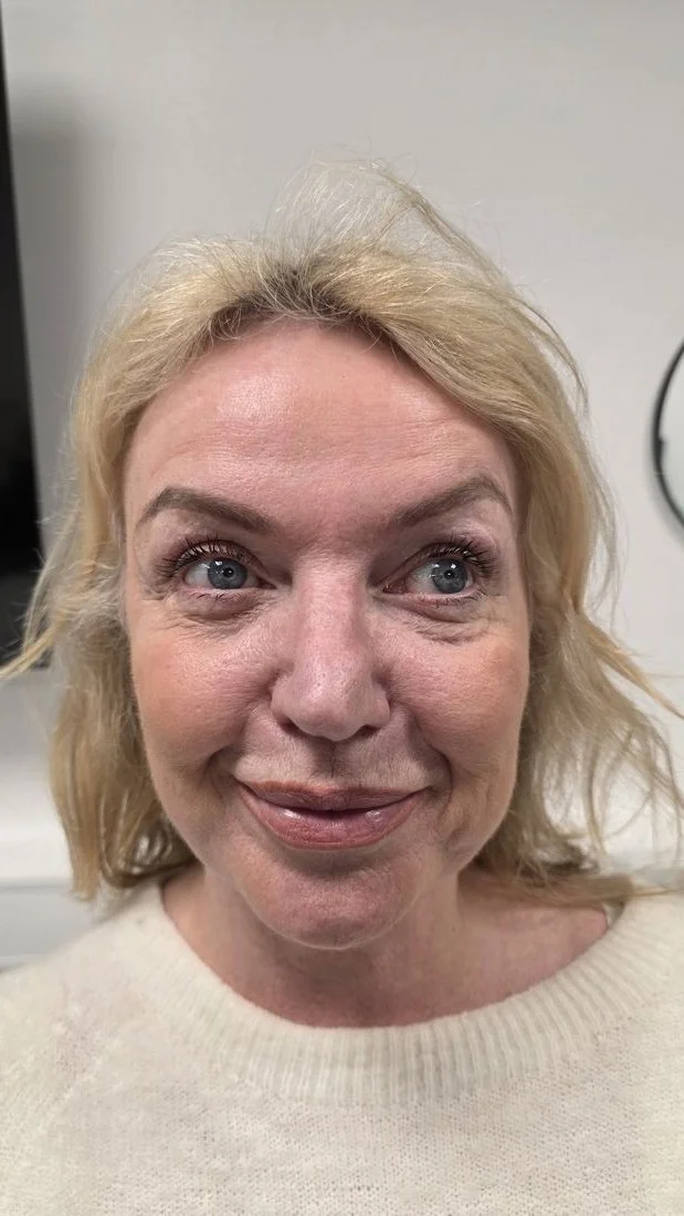 juvelook-bio-stimulator-before-treatment-face.jpg