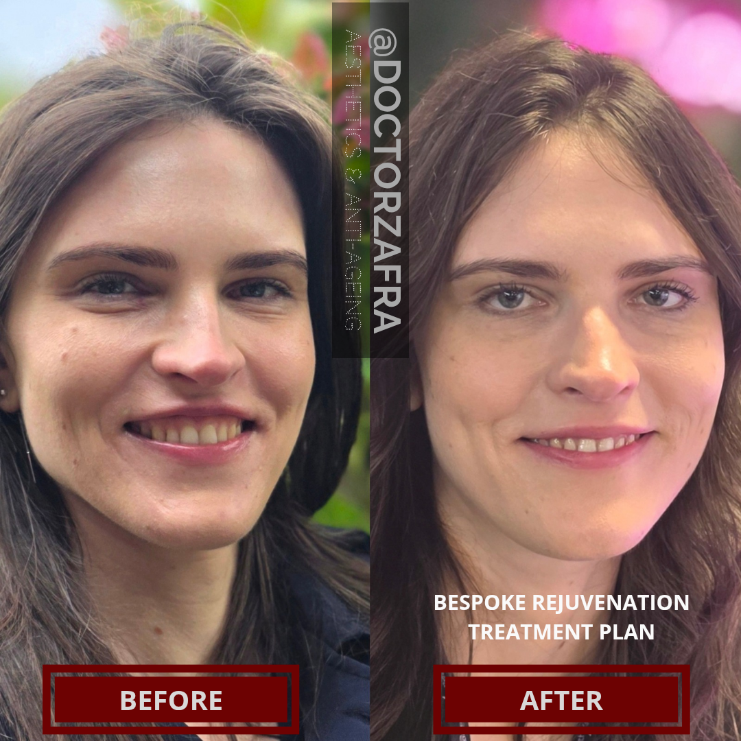 1 Bespoke Rejuvenation Plan.png