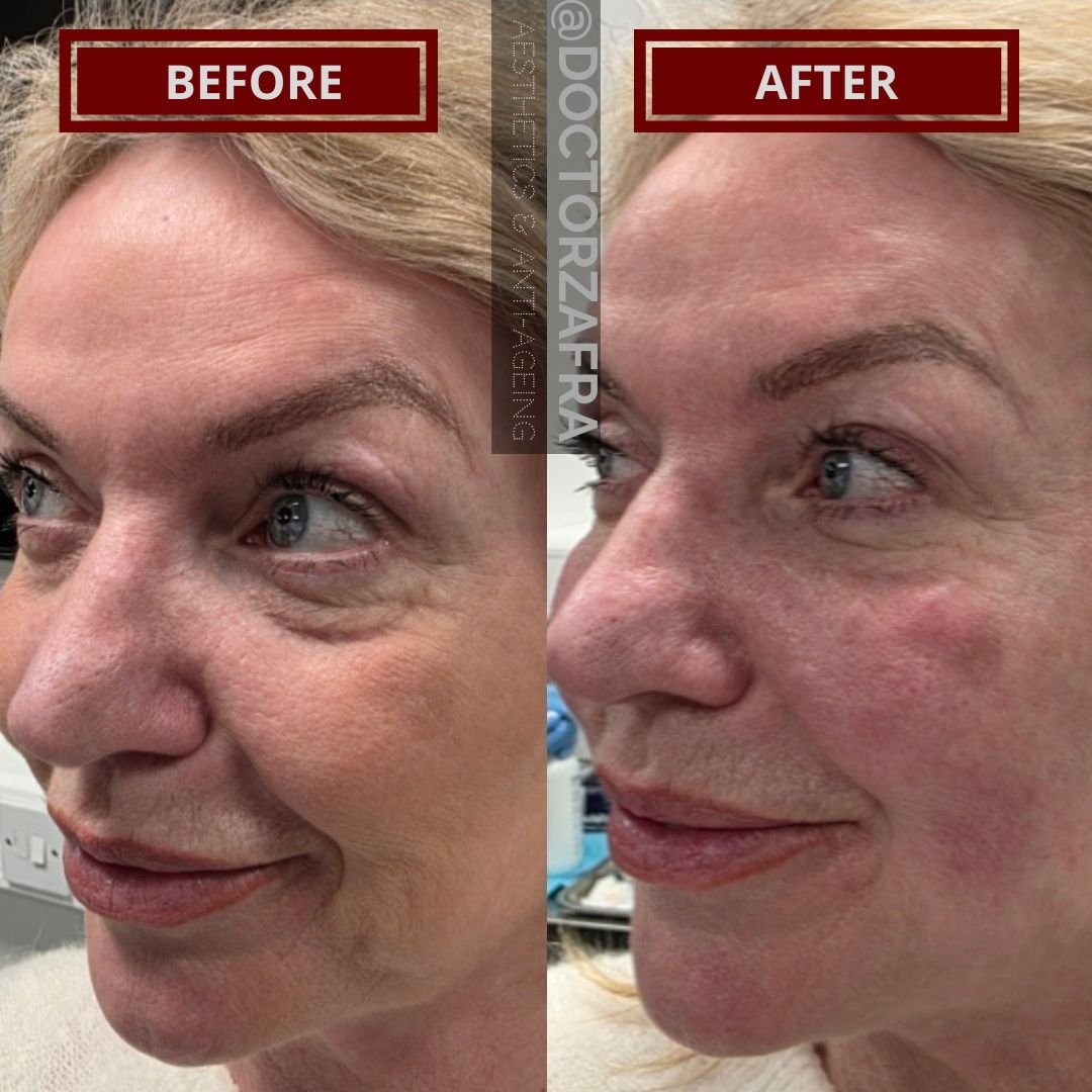 Ageing-Rejuvenated_20260122_181534_0000.jpg